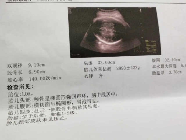 双顶径和股骨长检查单